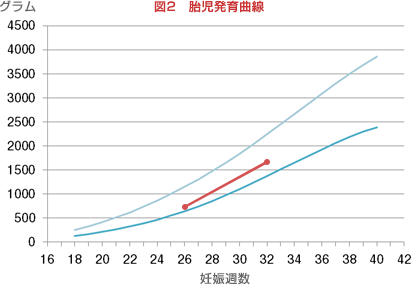 図2 胎児発育曲線