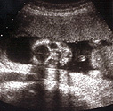 この写真をみてうちの子カワイイ!!と思えるのはやっぱり私たちだけか・ ・ この写真をみてうちの子カワイイ!!と思えるのはやっぱり私たちだけか・ ・