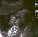 Tyler @ 31 weeks�̂���B�R�u�^�������݂ɑ傫���@�́A���̕@�ɂ�������B���肢������A�p�p�̏����ȕ@��������ĂˁE�E�B