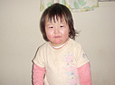 目が腫れちゃってます…