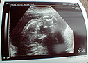 これがエコー写真。これをかわいいと思えるのは親だからこそ。 これがエコー写真。これをかわいいと思えるのは親だからこそ。